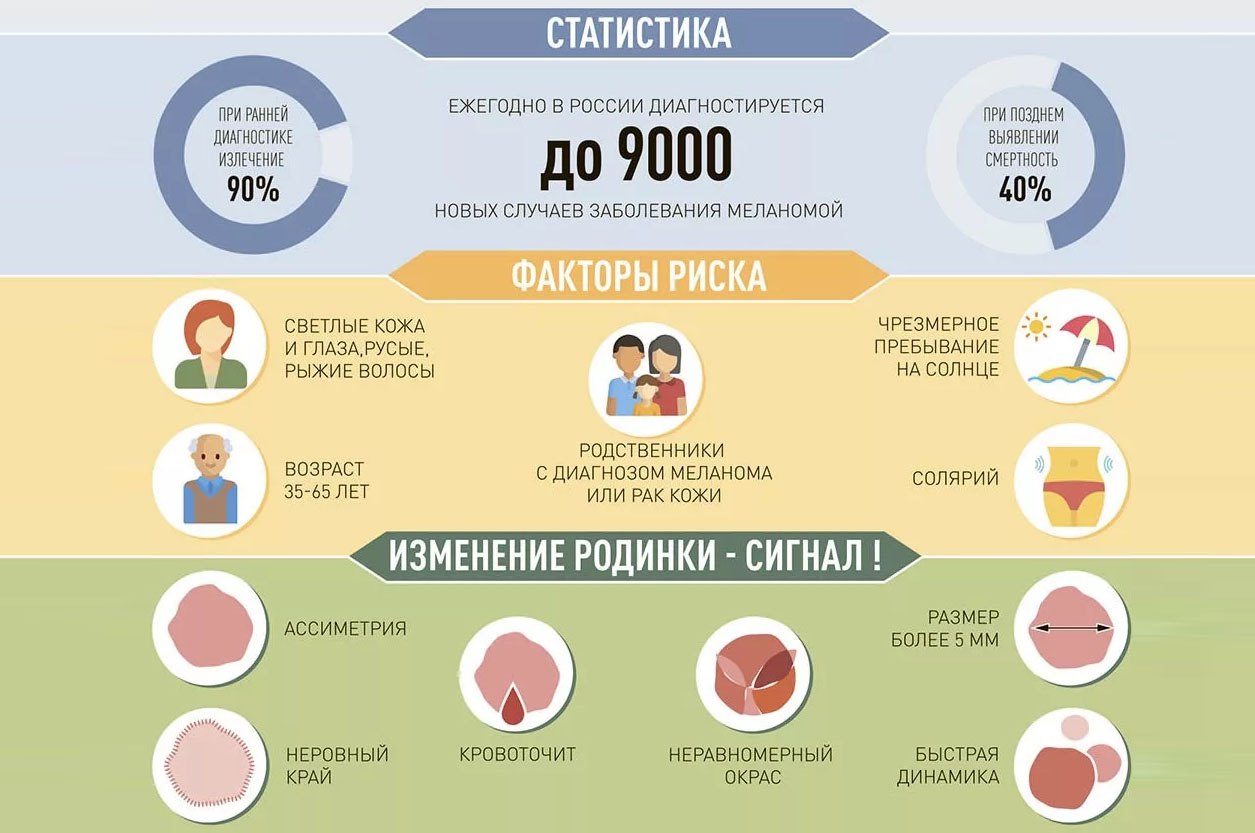 Как отличить родинку от меланомы - инфографика